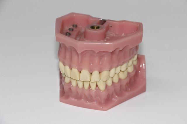 Bild Zahnprothese
